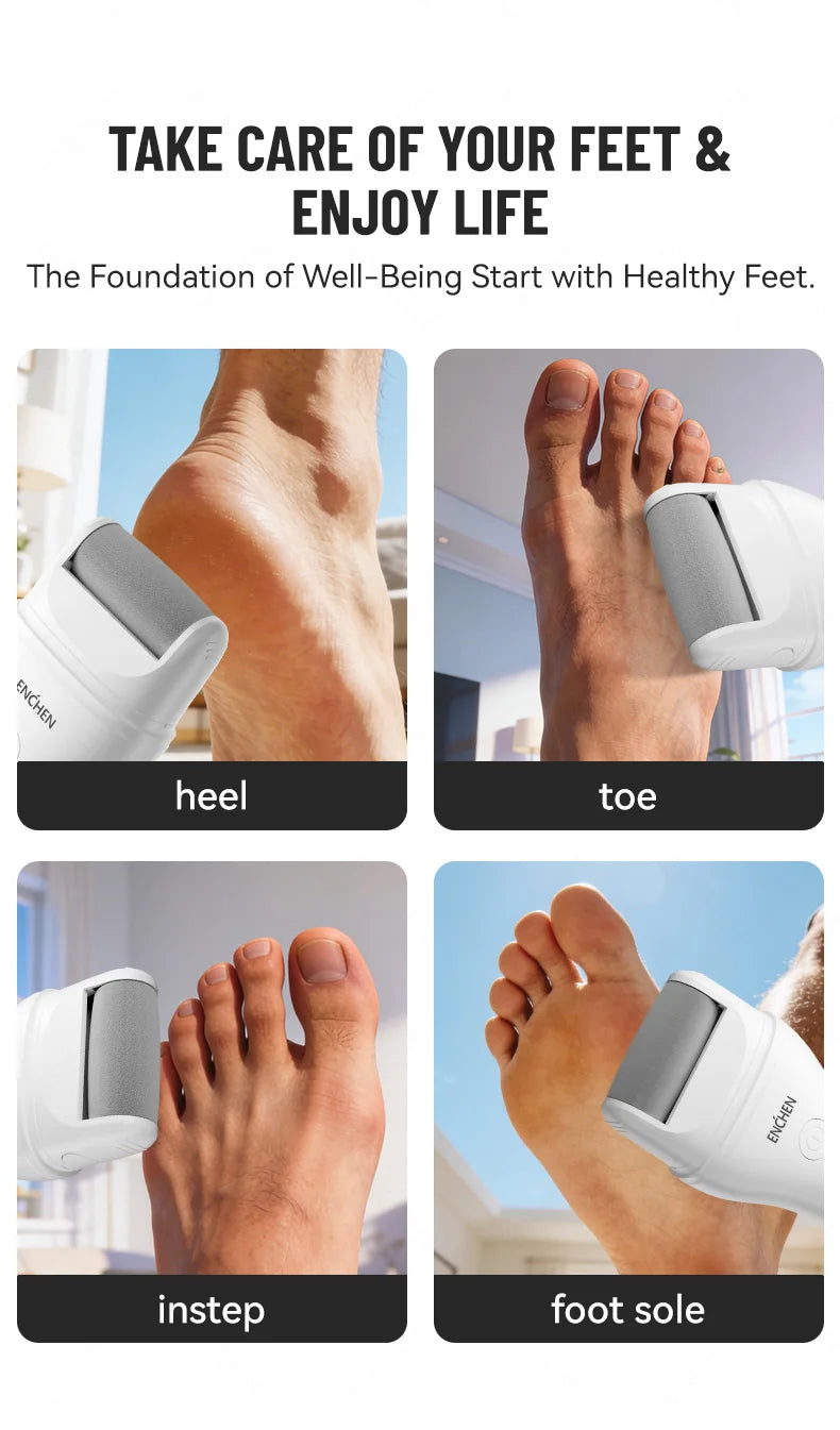 Enchen Electric Foot Callus Remover Rechargeable Ipx6 Waterproof 2 Speeds USB Charging 1 Sanding Head
