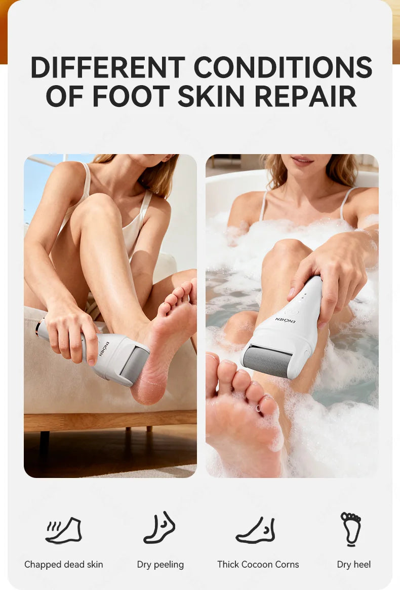 Enchen Electric Foot Callus Remover Rechargeable Ipx6 Waterproof 2 Speeds USB Charging 1 Sanding Head